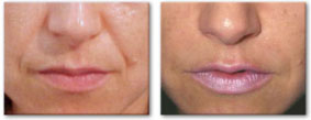 Before and After Photo 2
