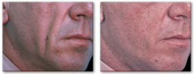 Before and After Photo 4