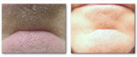 Before and After Photo 4