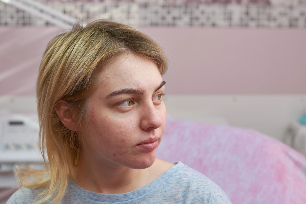 The Family Impact of Severe Acne